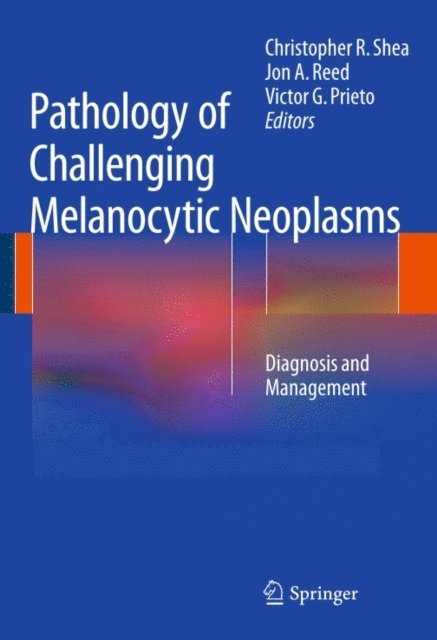 Victor G. Prieto, Jon A. Reed, Christopher R. Shea - Pathology of Challenging Melanocytic Neoplasms, E-bok
