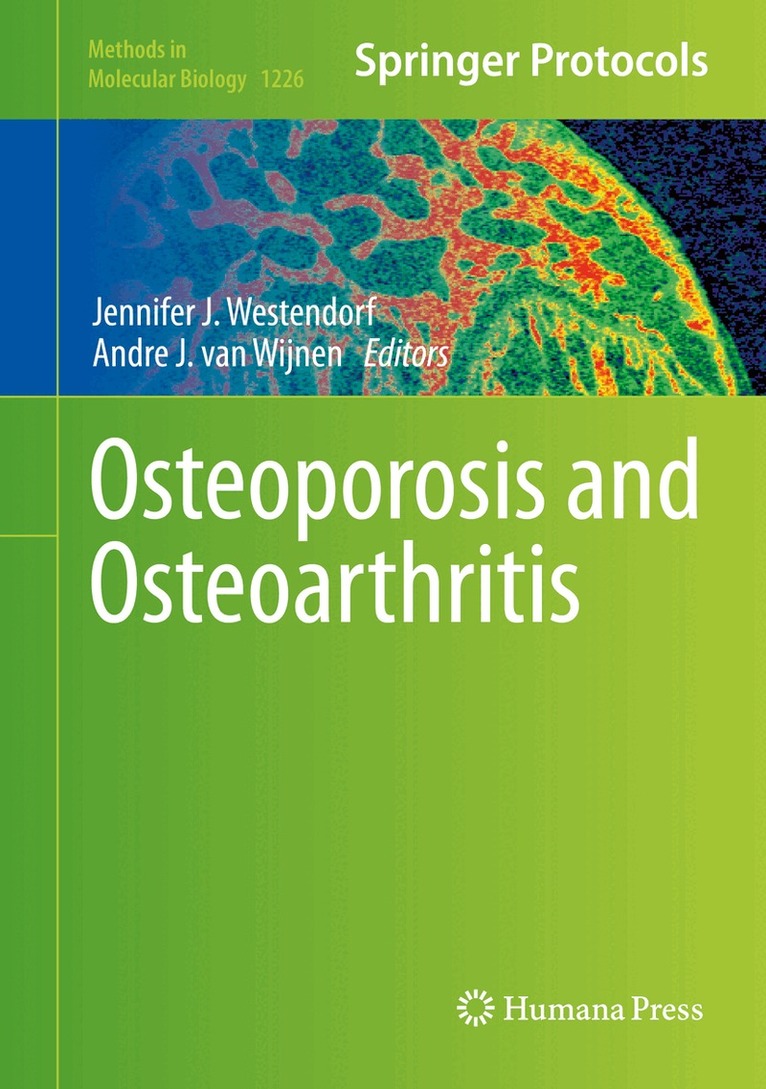 Jennifer J. Westendorf, Andre J. van Wijnen - Osteoporosis and Osteoarthritis, Inbunden
