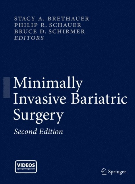 Bruce D. Schirmer, Philip R. Schauer, Stacy A. Brethauer - Minimally Invasive Bariatric Surgery, E-bok