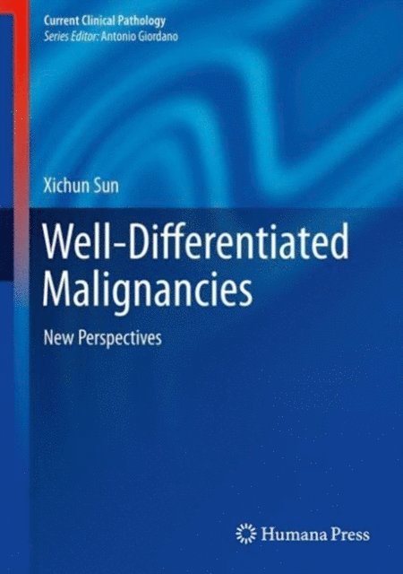 Xichun Sun - Well-Differentiated Malignancies, E-bok