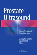 Prostate Ultrasound