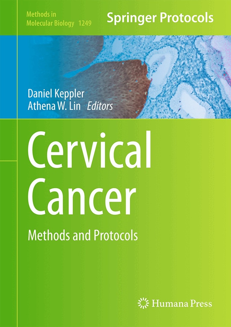 Daniel Keppler, Athena W. Lin - Cervical Cancer, Inbunden