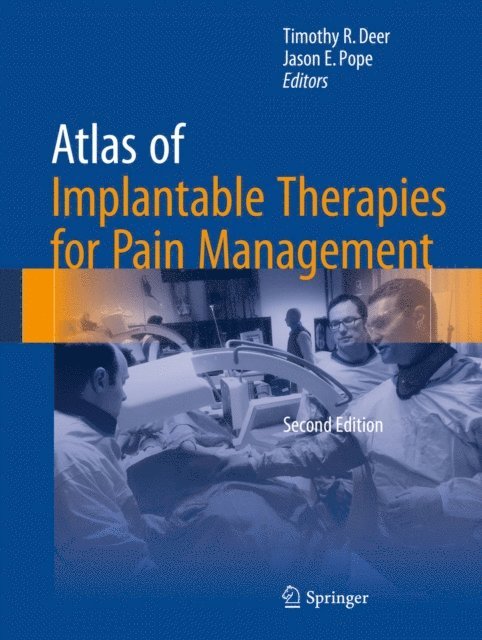 Jason E. Pope, Timothy R. Deer - Atlas of Implantable Therapies for Pain Management, E-bok