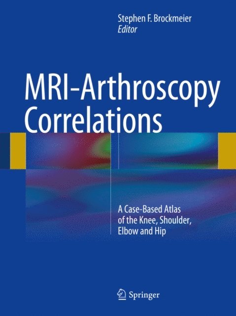 Stephen F. Brockmeier - MRI-Arthroscopy Correlations, E-bok