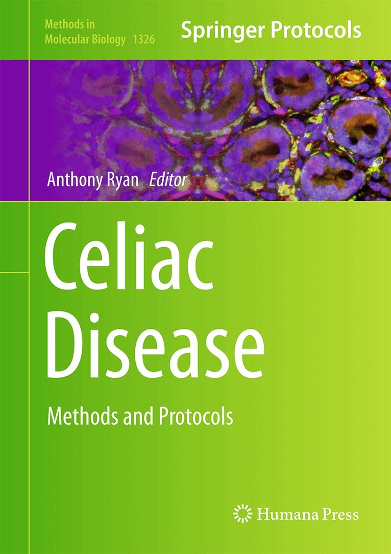Anthony W. Ryan - Celiac Disease, Inbunden