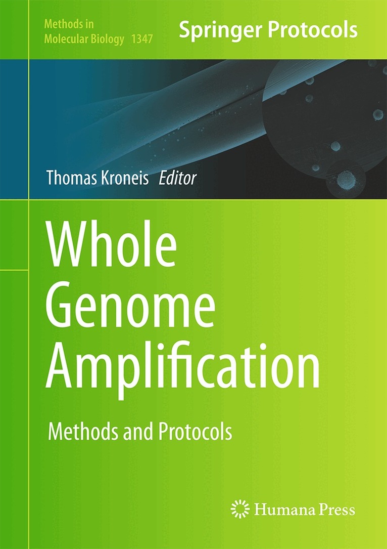 Thomas Kroneis - Whole Genome Amplification, Inbunden