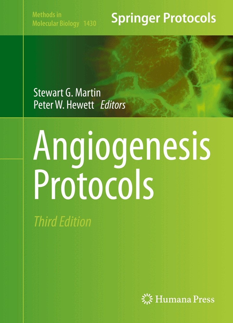 Stewart G. Martin, Peter W. Hewett - Angiogenesis Protocols, Inbunden