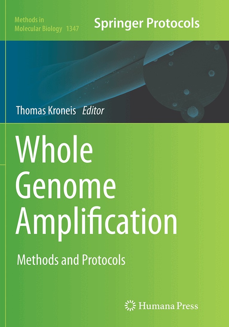 Thomas Kroneis - Whole Genome Amplification, Häftad