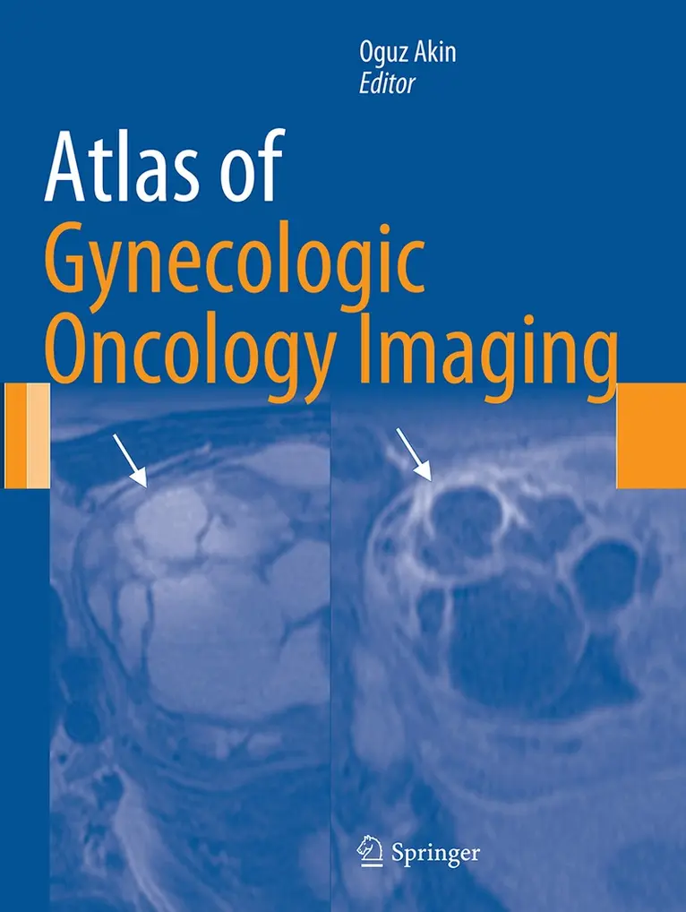 Oguz Akin - Atlas of Gynecologic Oncology Imaging, Häftad. Tillgänglighet: Lägg i varukorg