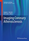 Imaging Coronary Atherosclerosis