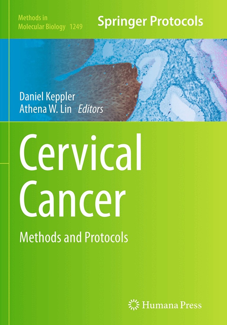 Daniel Keppler, Athena W. Lin - Cervical Cancer, Häftad