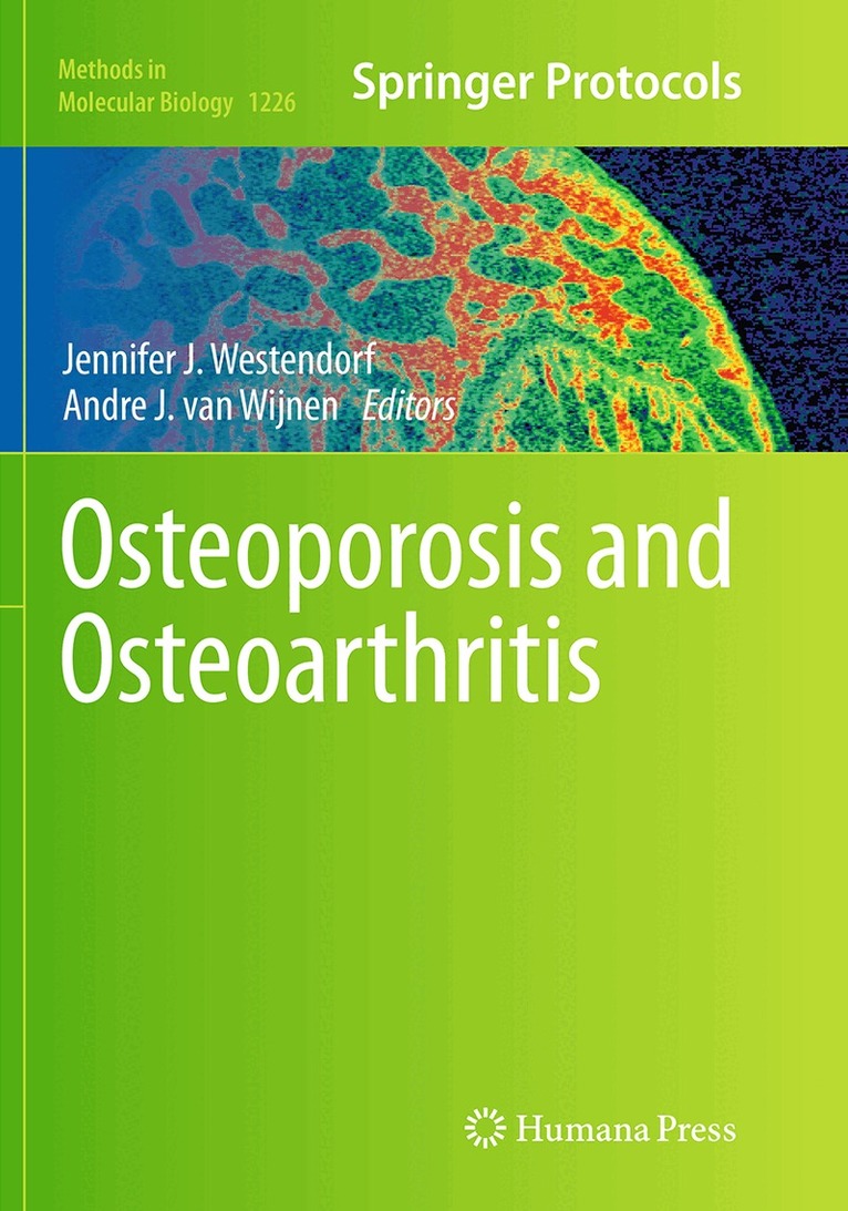 Jennifer J. Westendorf, Andre J. van Wijnen - Osteoporosis and Osteoarthritis, Häftad