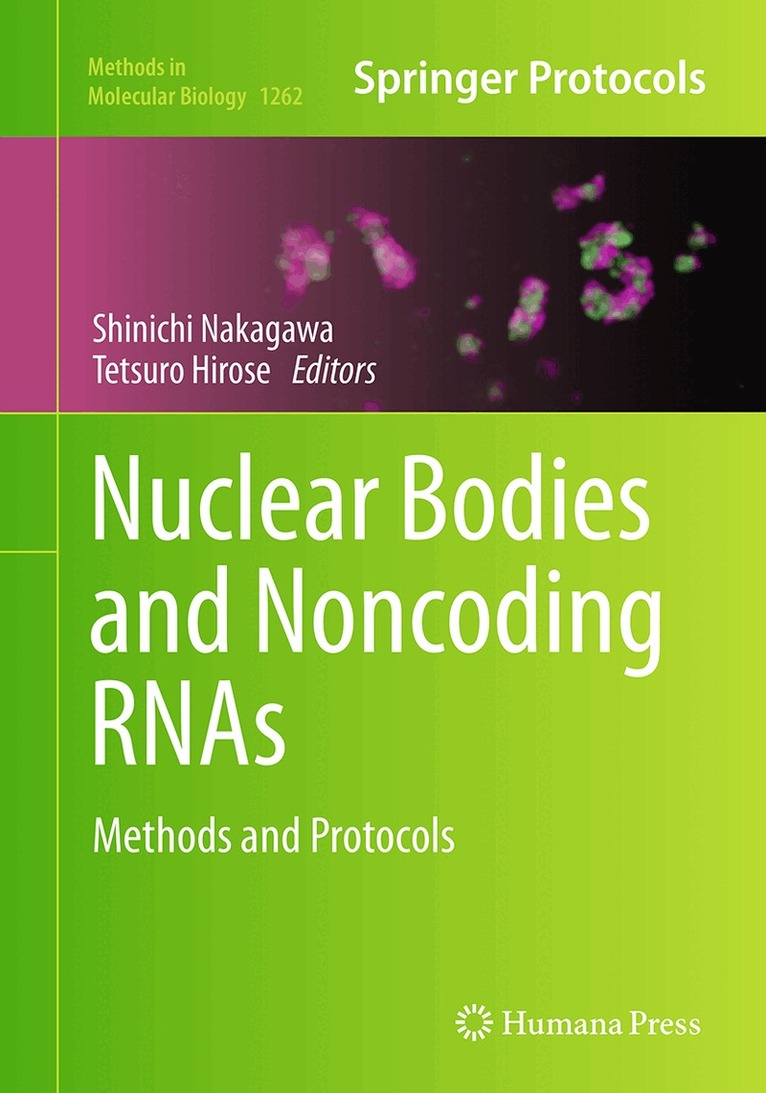 Shinichi Nakagawa, Tetsuro Hirose - Nuclear Bodies and Noncoding RNAs, Häftad. Tillgänglighet: Lägg i varukorg
