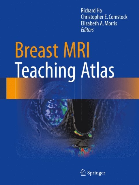 Elizabeth A. Morris, Christopher E. Comstock, Richard Ha - Breast MRI Teaching Atlas, E-bok