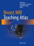 Breast MRI Teaching Atlas