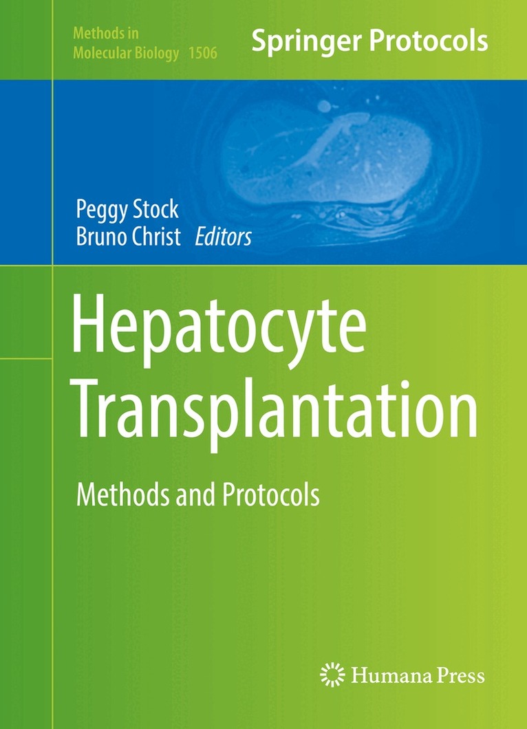 Peggy Stock, Bruno Christ - Hepatocyte Transplantation, Inbunden