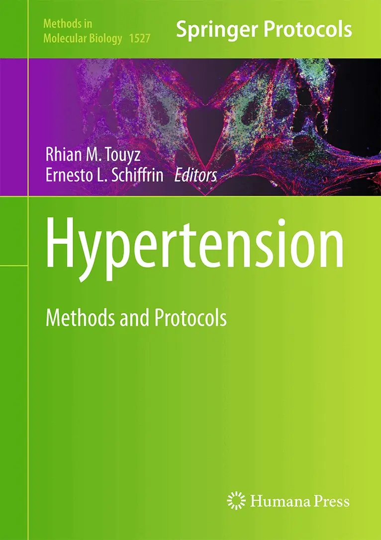 Rhian M. Touyz, Ernesto L. Schiffrin - Hypertension, Inbunden. Tillgänglighet: Lägg i varukorg