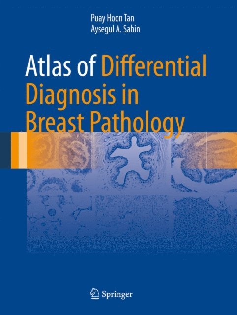 Aysegul A. Sahin, Puay Hoon Tan - Atlas of Differential Diagnosis in Breast Pathology, E-bok