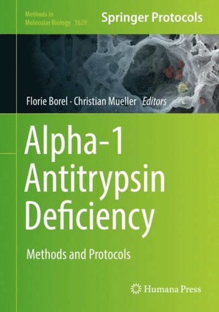 Christian Mueller, Florie Borel - Alpha-1 Antitrypsin Deficiency, E-bok