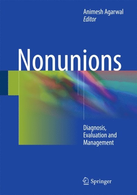 Animesh Agarwal - Nonunions, E-bok