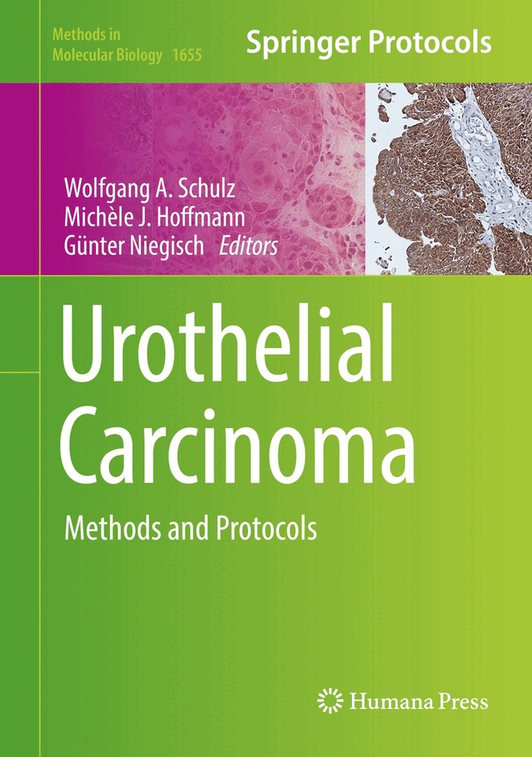 Wolfgang A Schulz, Michèle J. Hoffmann, Günter Niegisch - Urothelial Carcinoma, Inbunden