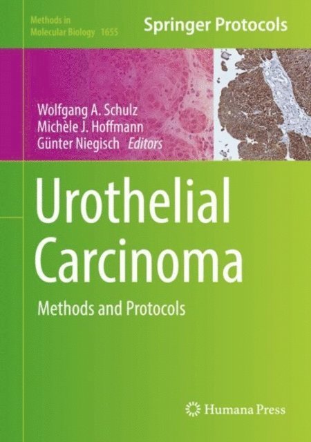 Gunter Niegisch, Michele J. Hoffmann, Wolfgang A Schulz - Urothelial Carcinoma, E-bok
