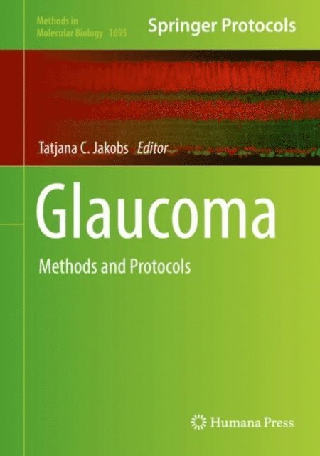 Tatjana C. Jakobs - Glaucoma, E-bok