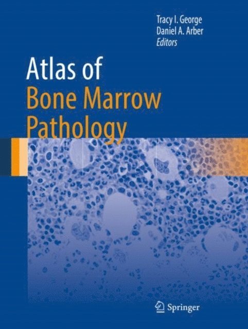 Daniel A. Arber, Tracy I. George - Atlas of Bone Marrow Pathology, E-bok