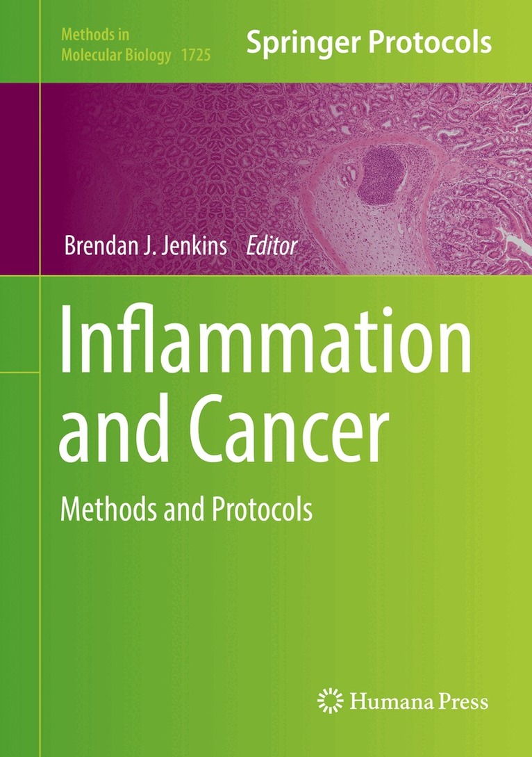 Brendan J. Jenkins - Inflammation and Cancer, Inbunden