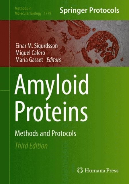 Maria Gasset, Miguel Calero, Einar M. Sigurdsson - Amyloid Proteins, E-bok