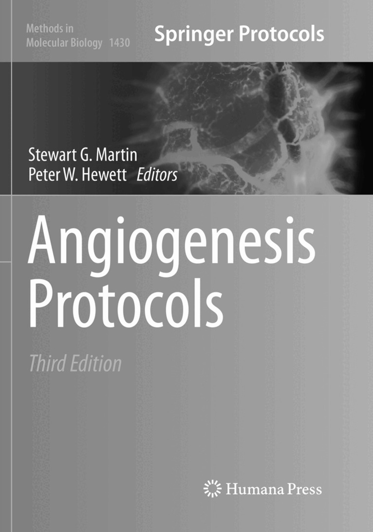 Stewart G. Martin, Peter W. Hewett - Angiogenesis Protocols, Häftad
