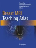 Breast MRI Teaching Atlas