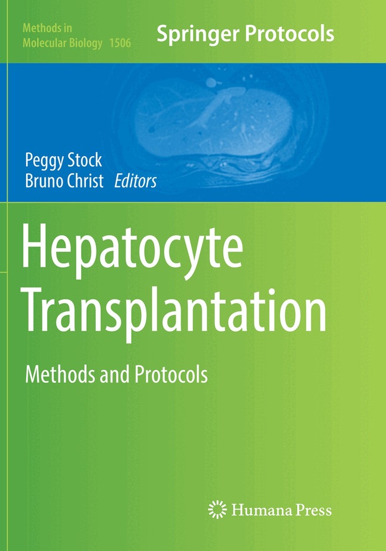 Peggy Stock, Bruno Christ - Hepatocyte Transplantation, Häftad