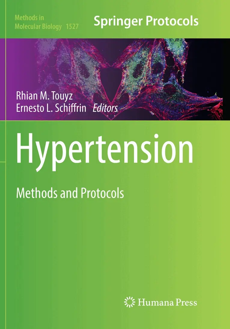 Rhian M. Touyz, Ernesto L. Schiffrin - Hypertension, Häftad. Tillgänglighet: Lägg i varukorg