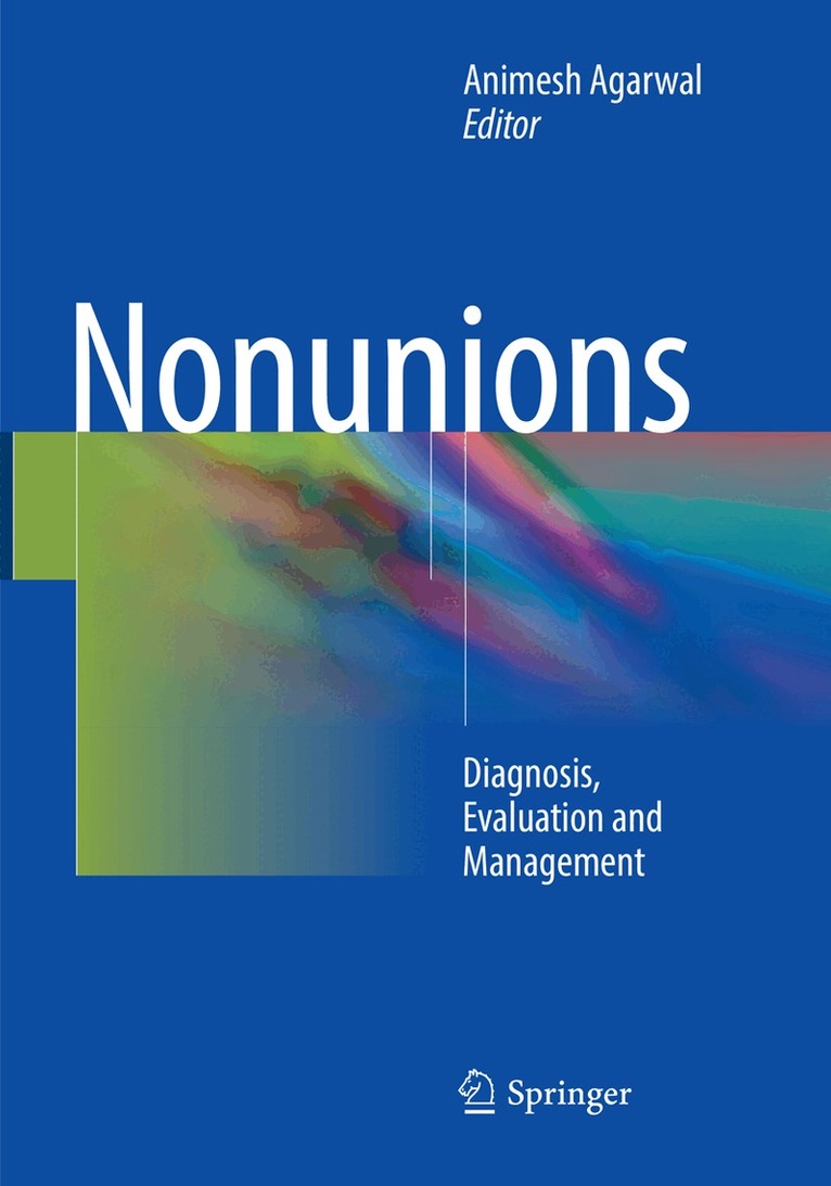 Animesh Agarwal - Nonunions, Häftad