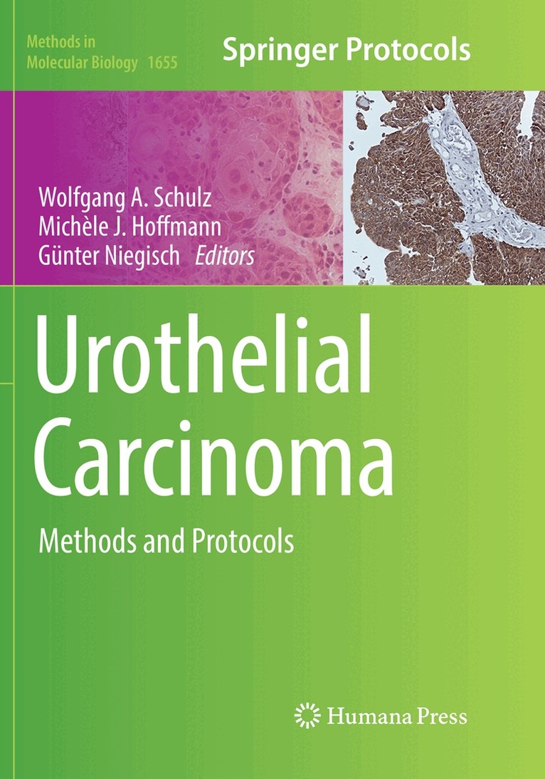 Wolfgang A Schulz, Michèle J. Hoffmann, Günter Niegisch - Urothelial Carcinoma, Häftad