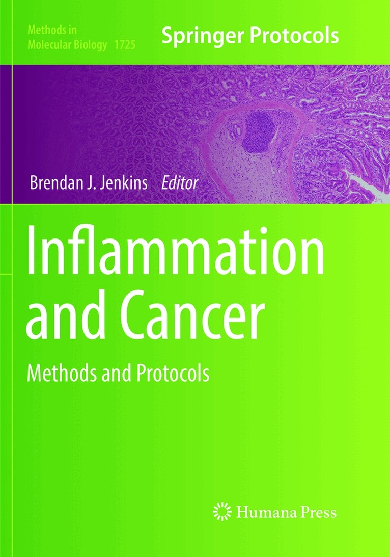 Brendan J. Jenkins - Inflammation and Cancer, Häftad