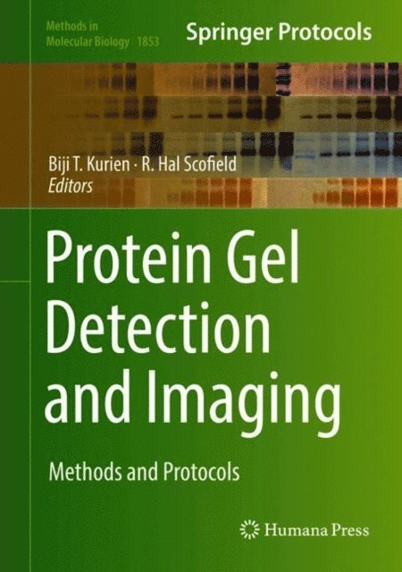 R. Hal Scofield, Biji T. Kurien - Protein Gel Detection and Imaging, E-bok