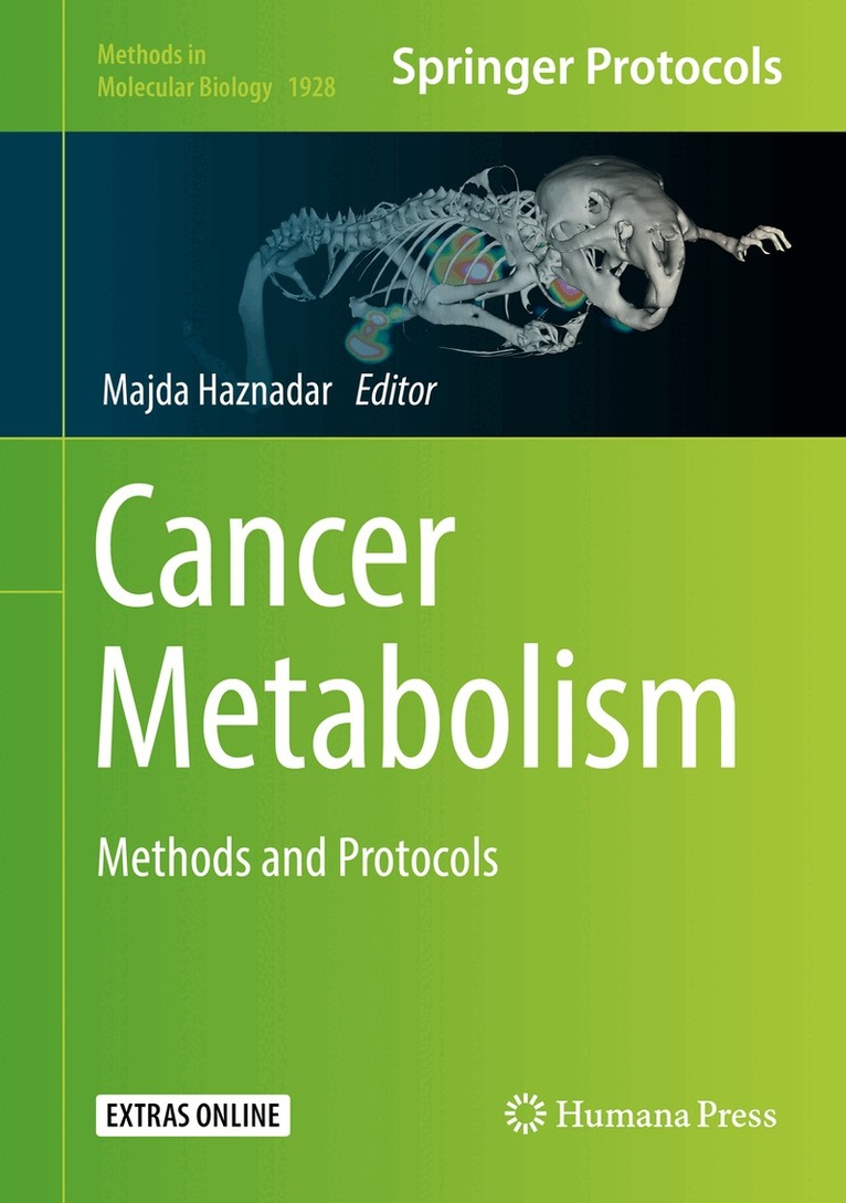 Majda Haznadar - Cancer Metabolism, Inbunden