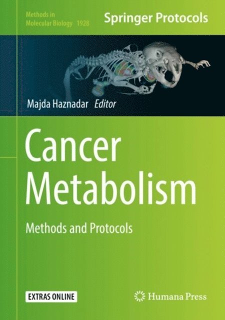 Majda Haznadar - Cancer Metabolism, E-bok