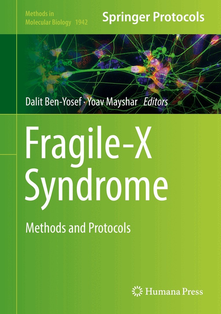 Dalit Ben-Yosef, Yoav Mayshar - Fragile-X Syndrome, Inbunden