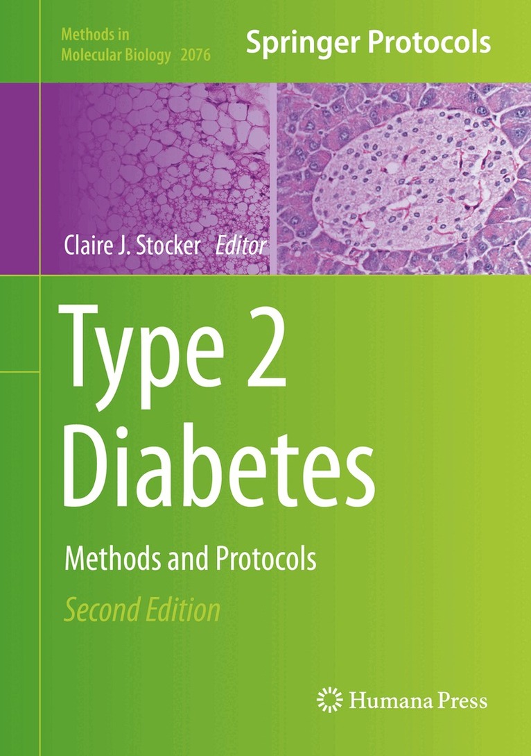 Claire J. Stocker - Type 2 Diabetes, Inbunden