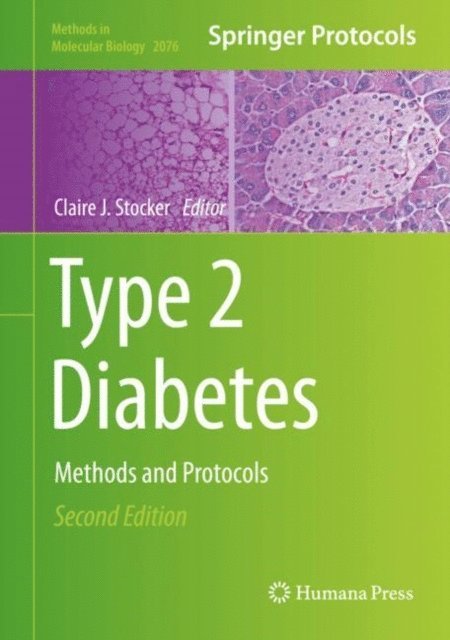 Claire J. Stocker - Type 2 Diabetes, E-bok