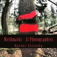 Birthmarks - 31 Photographies