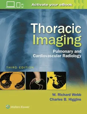 W. Richard Webb, Charles B. Higgins - Thoracic Imaging : Pulmonary and Cardiovascular Radiology, Inbunden. Tillgänglighet: Lägg i varukorg