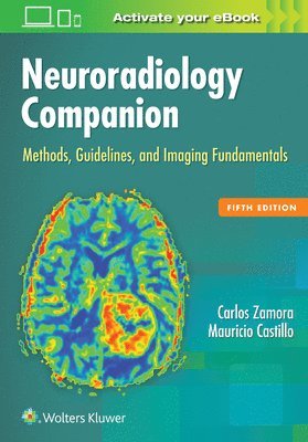 Carlos Zamora, Mauricio Castillo - Neuroradiology Companion : Methods, Guidelines, and Imaging Fundamentals. Tillgänglighet: Lägg i varukorg