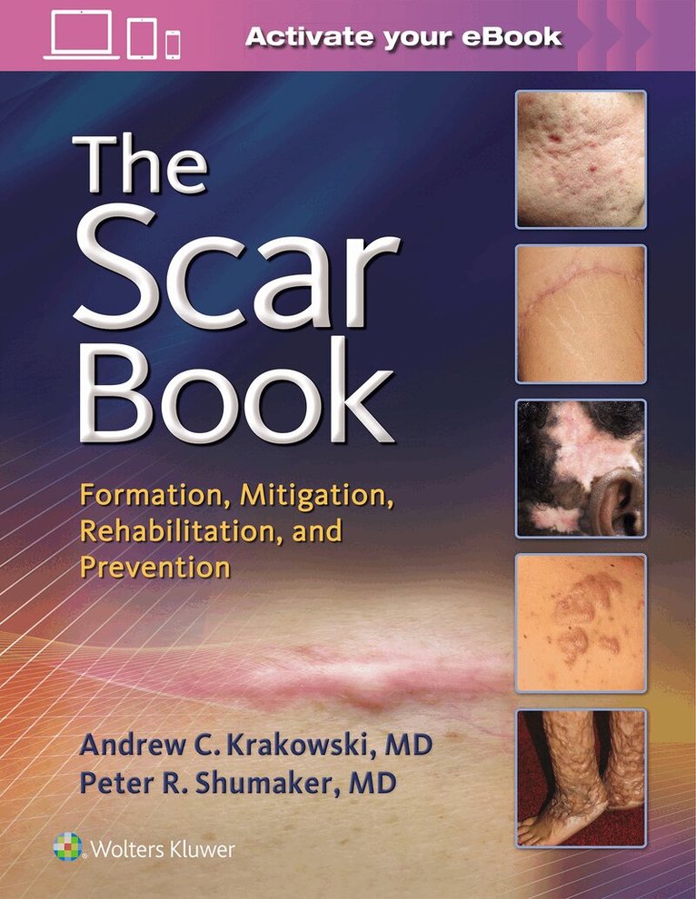 Scar Book