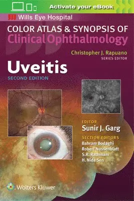 Sunir J. Garg - Uveitis, Övrigt. Tillgänglighet: Lägg i varukorg