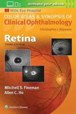 Mitchell Fineman - Retina, Övrigt. Tillgänglighet: Lägg i varukorg
