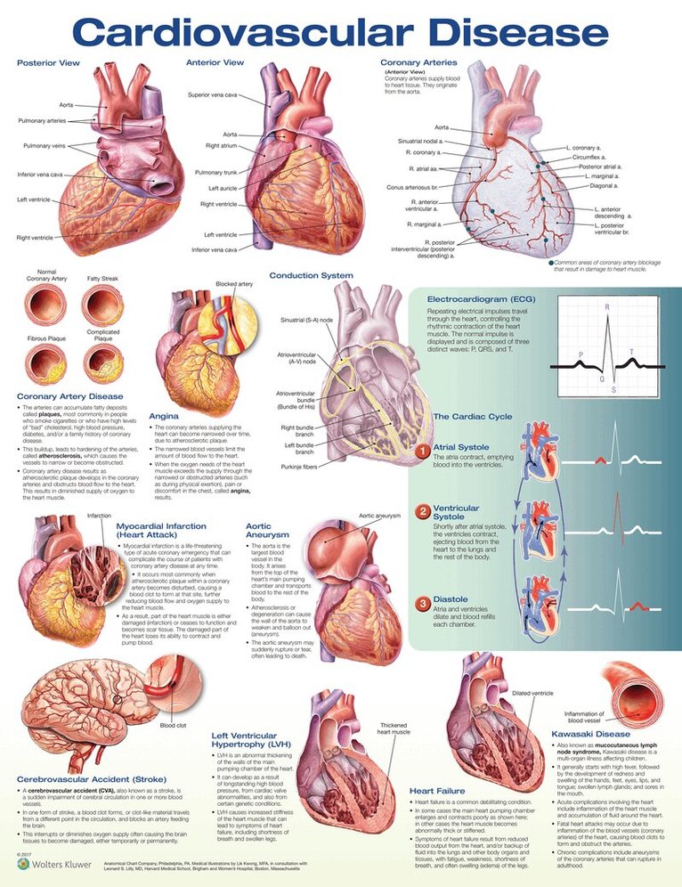 Cardiovascular Disease Anatomical Chart, Övrigt